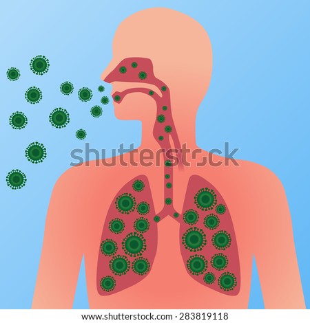 Virus And Infection, Image Illustration - Stock Vector