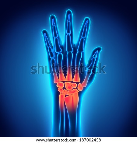 Medical Illustration Hands Anatomy Bones Tendons Stock Vector 84478732