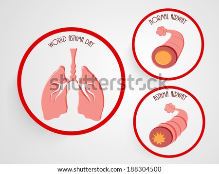 how lengthy will bronchitis be contagious