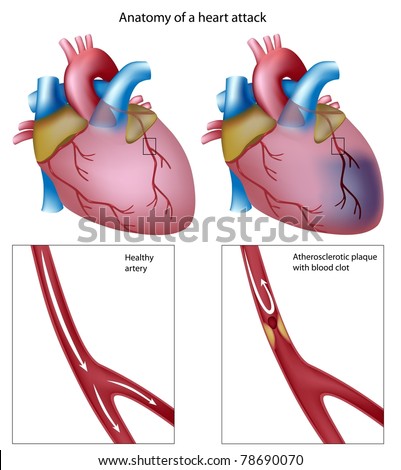 Pathway Blood Flow Through Heart Stock Illustration 76386163 - Shutterstock