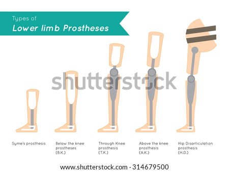 types of prothesis types of prothesis
