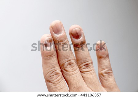 soft thumb nails porn celeb pics