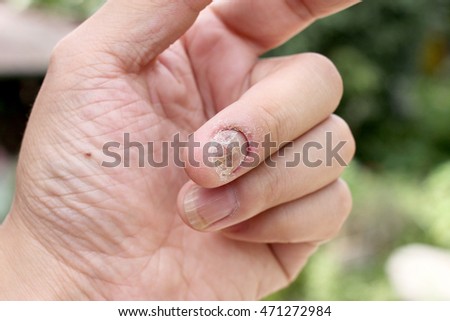 soft thumb nails young hot girls pussys