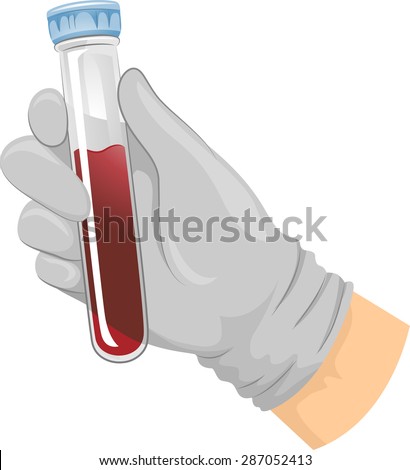 Blood Sample Stock Images Royalty Free Images Vectors Shutterstock