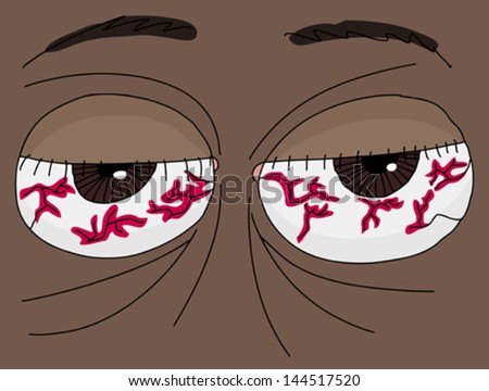 Close up of a pair of human bloodshot eyes - stock vector