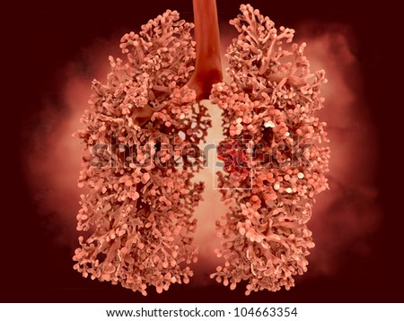 Lung cancer  stock photo