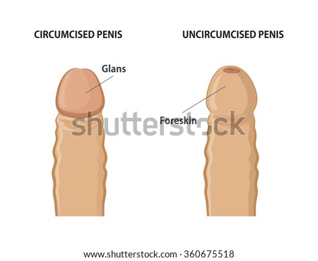 How To Clean A Circumcised Penis 71