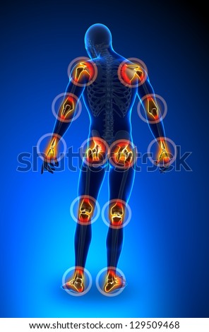 Arthritis Stock Photos, Images, & Pictures | Shutterstock