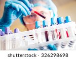 Medical Pipette Free Stock Photo - Public Domain Pictures