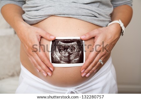 Close up of pregnant woman holding ultrasound scan on her tummy