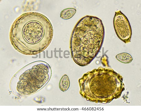 Eggs Helminth Stool Analyze By Microscope Stock Photo (Edit Now ...