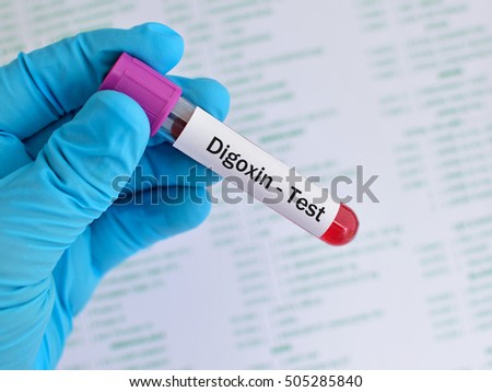 Oral ivermectin for head lice treatment