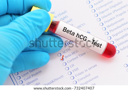 Hcg serum ovarian cancer
