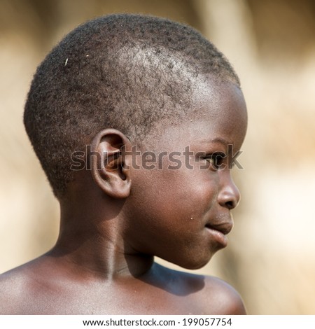 Profile Caucasian Child Showing Hair Loss Stock Photo 76481824 ...