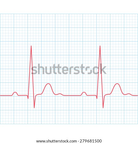 medical electrocardiogram ecg on grid paper stock vector 279681500