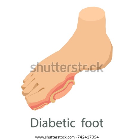 Foot Ulcer Stock Images, Royalty-Free Images & Vectors | Shutterstock