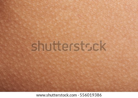 goose bumps on human skin closeup stock photo 556019386 goose bumps on human skin closeup stock photo 556019386 goose bumps on human skin closeup stock photo 556019386 goose bumps on human skin closeup stock photo 556019386