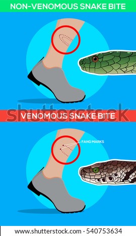 Venomous Snake Bite Leg Snakebite Beware Stock Vector 540753640 ...