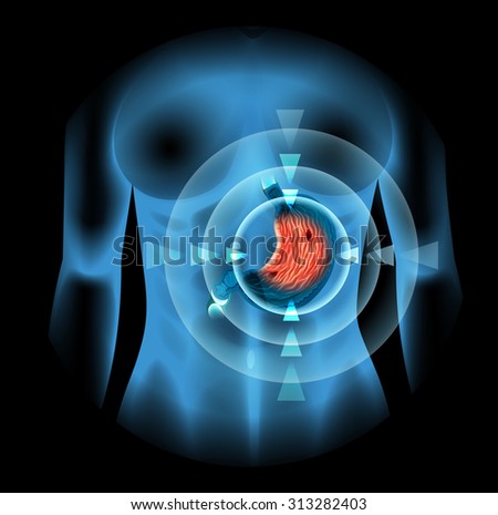 an analysis of the stomach ulcer the symptoms and causes in medical research Stomach cancer, also known as gastric cancer, is a cancer which develops from the lining of the stomach early symptoms may include heartburn, upper abdominal pain, nausea and loss of appetite later signs and symptoms may include weight loss, yellowing of the skin and whites of the eyes, vomiting, difficulty swallowing and blood in the stool among others. an analysis of the stomach ulcer the symptoms and causes in medical research Stomach cancer, also known as gastric cancer, is a cancer which develops from the lining of the stomach early symptoms may include heartburn, upper abdominal pain, nausea and loss of appetite later signs and symptoms may include weight loss, yellowing of the skin and whites of the eyes, vomiting, difficulty swallowing and blood in the stool among others.