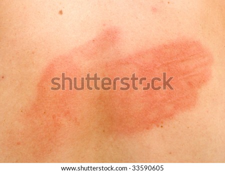 Hand Slap Stock Photos, Images, & Pictures | Shutterstock