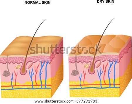 skin layers healthy normal human skin royalty free vector skin layers stock photos royalty free images vectors skin layers healthy normal human skin royalty free vector skin layers stock photos royalty free images vectors