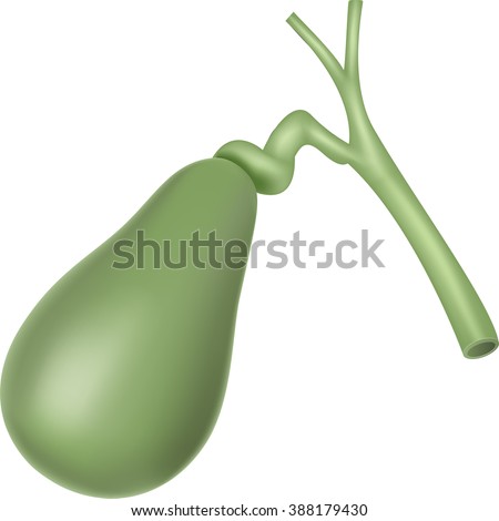 Illustration Artery Blocked Bad Cholesterol Stock Vector 325733324 ...