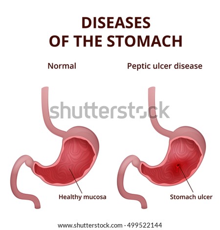 Stomach Anatomy Diagram Human Digestive Organ Stock Illustration ...