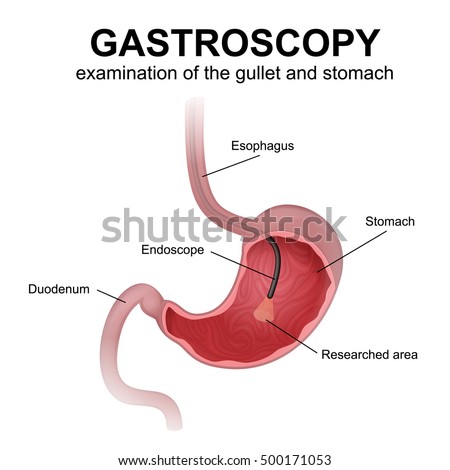 Esophagus Stock Images, Royalty-Free Images & Vectors | Shutterstock