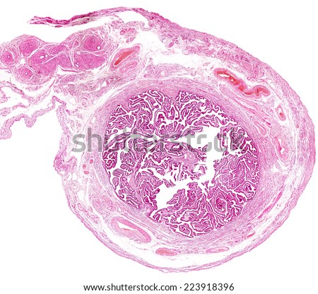 Cross Section Human Fallopian Tube Innermost Stock Photo (Royalty Free ...