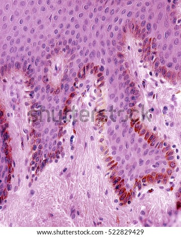 epidermis stock photo images 1 157 epidermis royalty free images and photography available to basal layer skin epidermis numerous melanocytes stock photo royalty free 522829429 epidermis stock photo images 1 157 epidermis royalty free images and photography available to basal layer skin epidermis numerous melanocytes stock photo royalty free 522829429