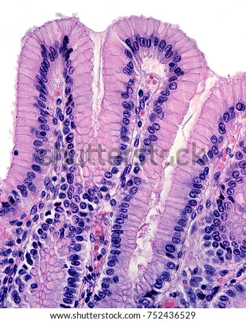 Surface Epithelium Stomach Invaginates Form Gastric Stock Photo ...