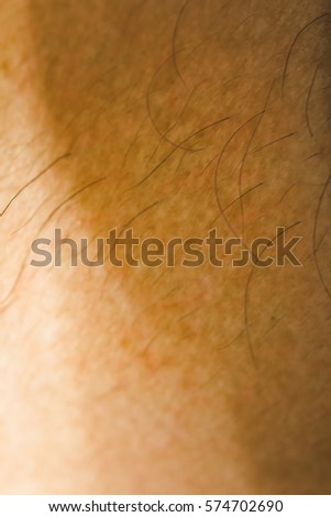 goose bumps on human skin closeup stock photo 556019386 goose bumps stock images royalty free images vectors goose bumps on human skin closeup stock photo 556019386 goose bumps stock images royalty free images vectors