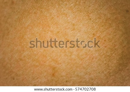 goose bumps on human skin closeup stock photo 556019386 goose bumps stock images royalty free images vectors goose bumps on human skin closeup stock photo 556019386 goose bumps stock images royalty free images vectors