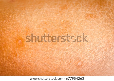 goose bumps on human skin closeup stock photo 556019386 goose bumps stock images royalty free images vectors goose bumps on human skin closeup stock photo 556019386 goose bumps stock images royalty free images vectors
