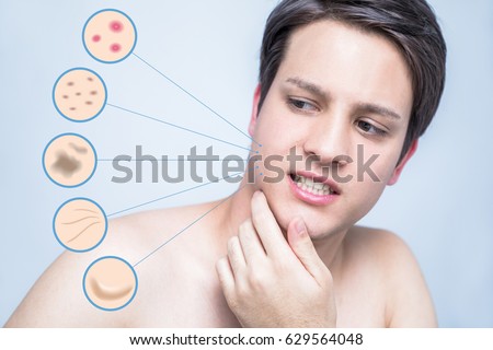 facial weight loosing skin Saggy after