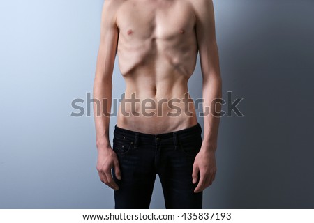 Anorexia Stock Images, Royalty-Free Images & Vectors | Shutterstock