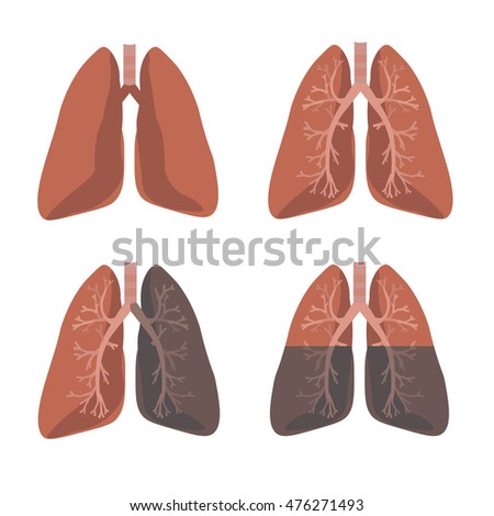 Human Lung Anatomy Set Flat Cartoon Stock Vector 476271493 - Shutterstock