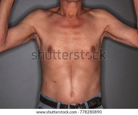 Belly Scar Stock Images, Royalty-Free Images & Vectors | Shutterstock