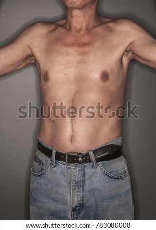 Belly Scar Stock Images, Royalty-Free Images & Vectors | Shutterstock