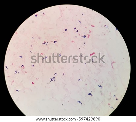 Gram-positive Stock Images, Royalty-Free Images & Vectors | Shutterstock