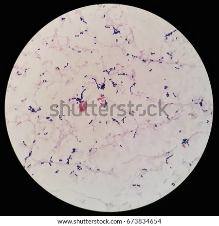 Gram Positive Cocci Blood Culture