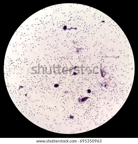 Smear Grams Stained Sputum Specimen Under Stock Photo 695350963 ...