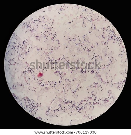 Gram Positive Cocci Blood Culture