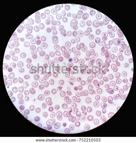 Human Blood Smear Under 100x Light Stock Photo 752210503 - Shutterstock