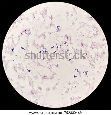 Smear Human Blood Culture Grams Stained Stock Photo 752880469 ...