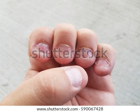 Fingernails Stock Images, Royalty-Free Images & Vectors | Shutterstock