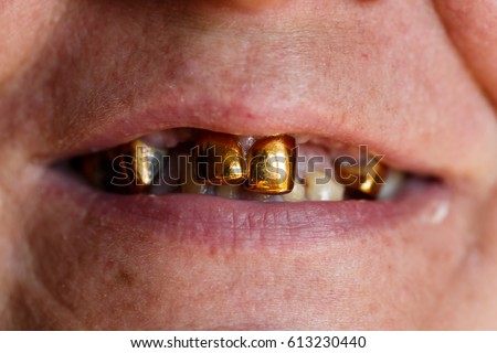 Rotten Teeth Stock Images, Royalty-Free Images & Vectors | Shutterstock