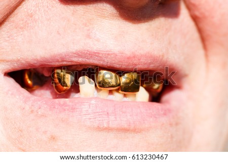 Rotten Teeth Stock Images, Royalty-Free Images & Vectors | Shutterstock