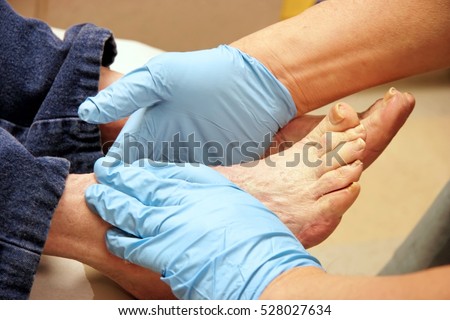 người phụ nữ cao cấp Nhận kiểm tra chân từ podiatrist đeo găng. Ngang.