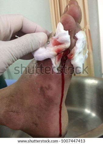 Wound Stock Images, Royalty-Free Images & Vectors | Shutterstock